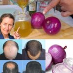 «El Poder del Aceite de Cebolla para un Cabello Más Fuerte y Saludable»