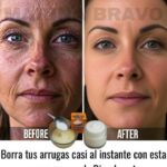 Aplicar Esta Máscara – Eliminar Las Arrugas En La Cara Y Te Hace Parecer Más Joven Que Tu Edad
