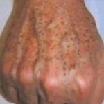 BICARBONATO DE SODIO PUEDE AYUDARTE A ELIMINAR LAS MANCHAS, ARRUGAS Y OJERAS