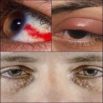 ¿Qué Dicen Tus Ojos Sobre Tu Salud?